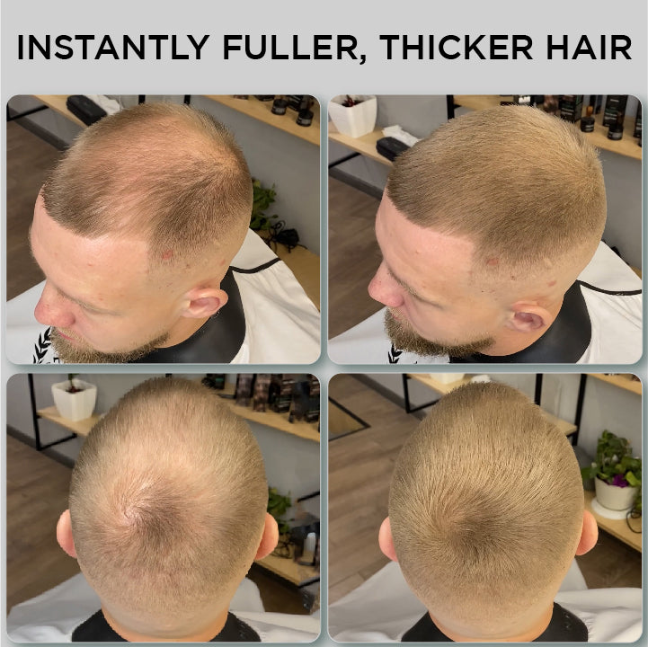 Hair Fibers 25g - Single Bottle