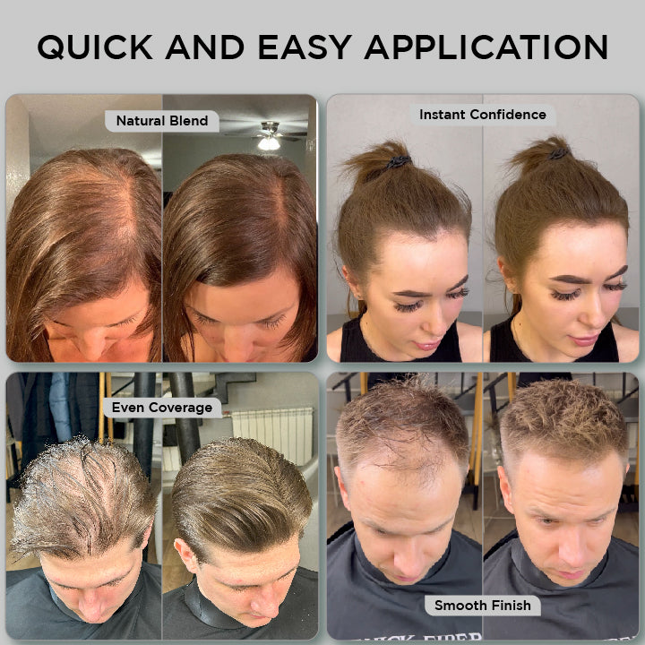 Hair Fibers 25g - Single Bottle